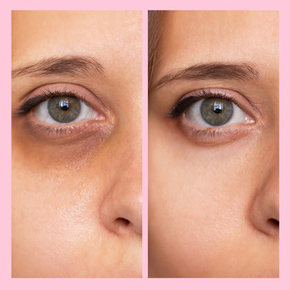 Radiant Eyes™ Anti Donkere Kringen Oogcreme